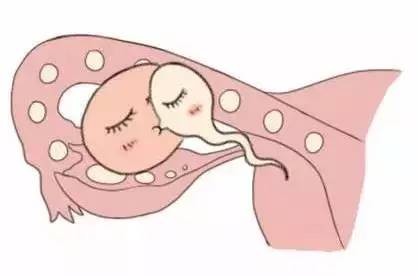案例